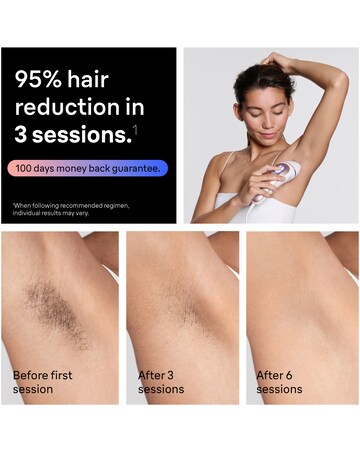 Braun Smart IPL Skin I expert, Free App 2 Smart Heads PL7211