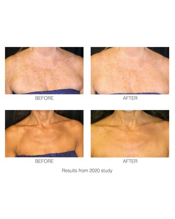 Rio DecoLite Neck & Cecolletage Beauty Boosting LED light