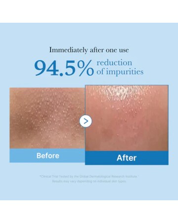 Medicube Pore Blackhead Deep Cleansing Oil 205ml