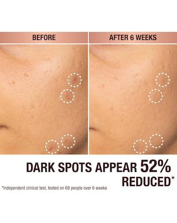 Charlotte Tilbury Dark Spot  Serum 30ml