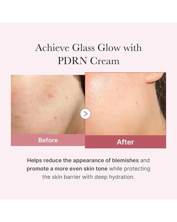 Medicube PDRN Pink Hyaluronic Moisturizing Cream 50ml